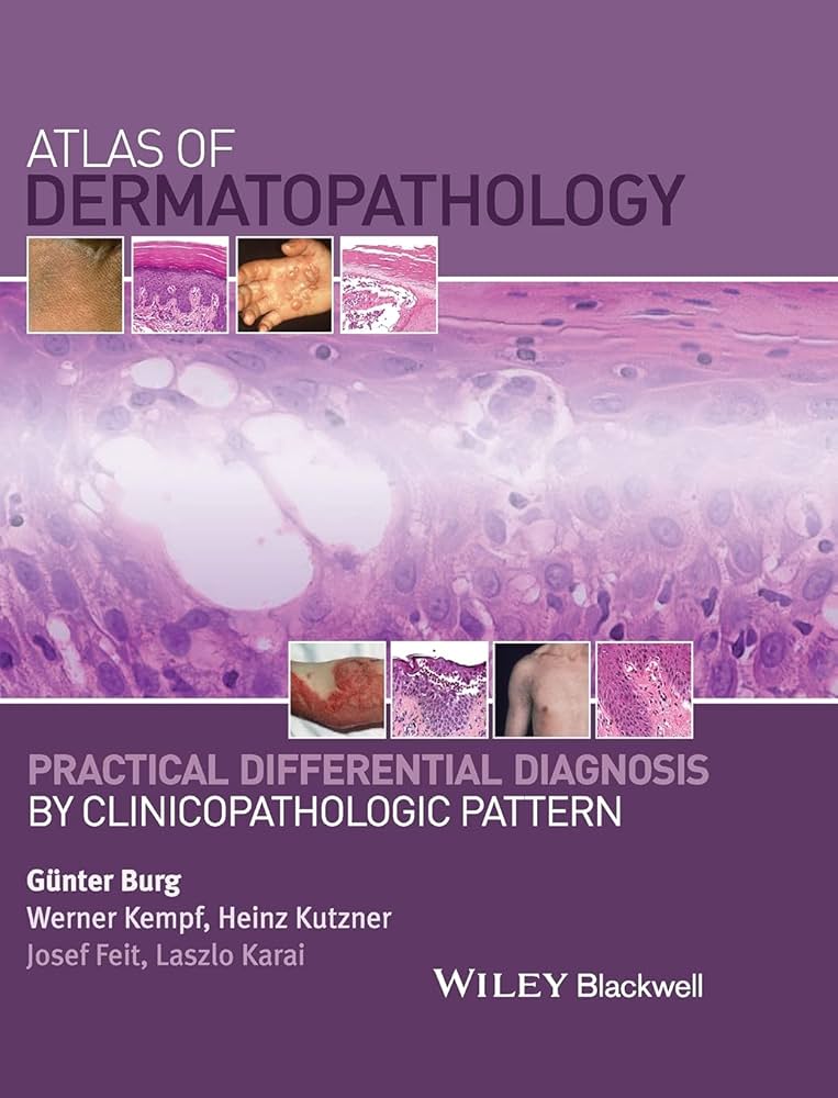 健康・医学 Differential Diagnosis Dermatopathology Color Atlas of Differential Diagnosis in Dermatopathology